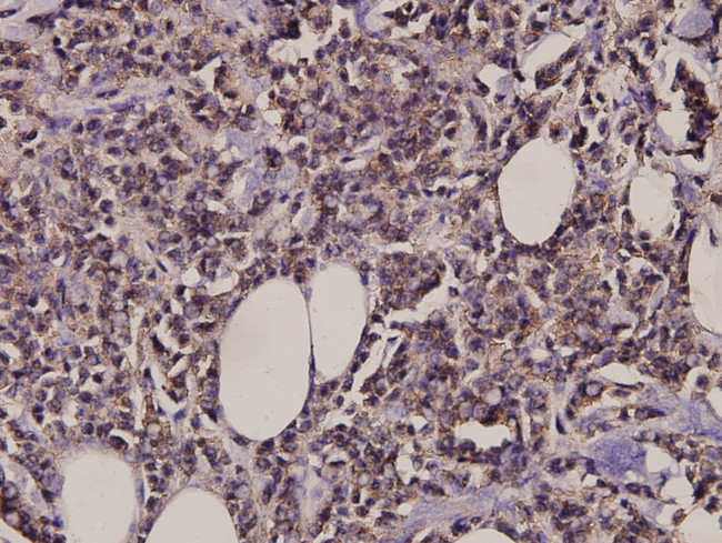 MARK Pan Antibody in Immunohistochemistry (Paraffin) (IHC (P))