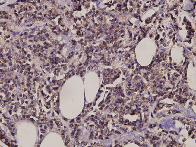 MARK Pan Antibody in Immunohistochemistry (Paraffin) (IHC (P))