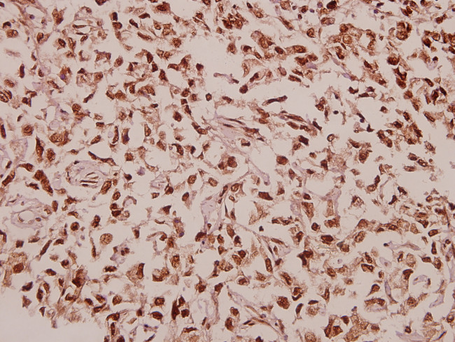 RPL39 Antibody in Immunohistochemistry (Paraffin) (IHC (P))