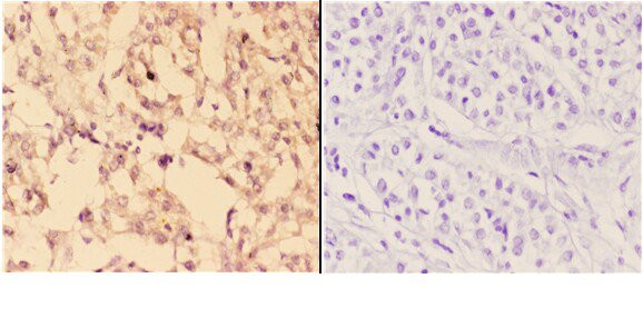 ABHD9 Antibody in Immunohistochemistry (Paraffin) (IHC (P))