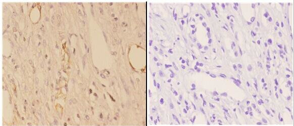 ABHD9 Antibody in Immunohistochemistry (Paraffin) (IHC (P))