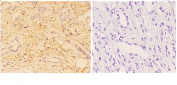 ACOT2 Antibody in Immunohistochemistry (Paraffin) (IHC (P))