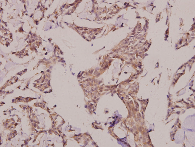 ACOT2 Antibody in Immunohistochemistry (Paraffin) (IHC (P))