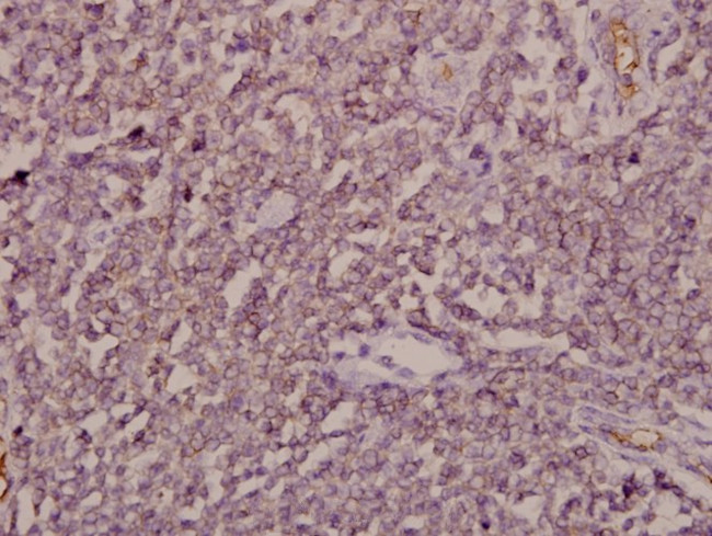 ARF4 Antibody in Immunohistochemistry (Paraffin) (IHC (P))