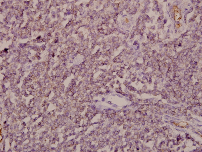 ARF4 Antibody in Immunohistochemistry (Paraffin) (IHC (P))