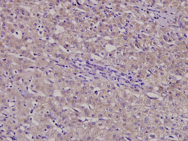 B4GALT3 Antibody in Immunohistochemistry (Paraffin) (IHC (P))