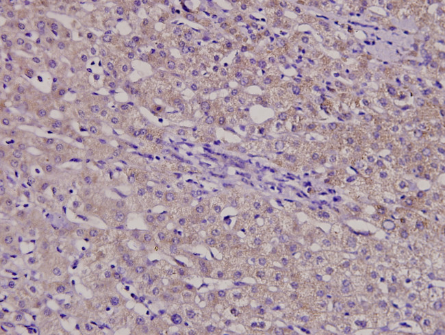 B4GALT3 Antibody in Immunohistochemistry (Paraffin) (IHC (P))