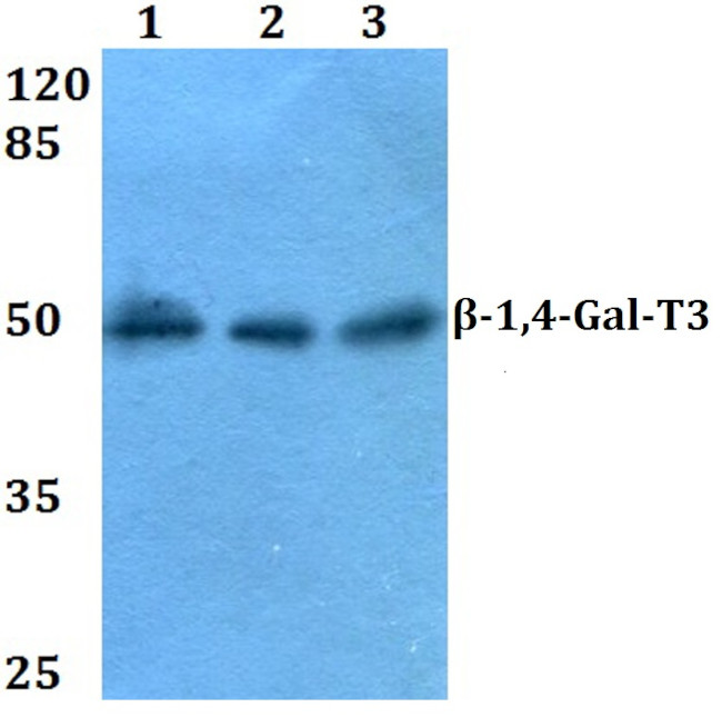 B4GALT3 Antibody in Western Blot (WB)