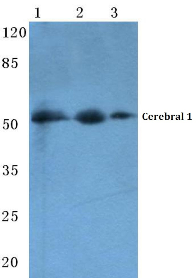 Cerebral Protein 1 Antibody in Western Blot (WB)