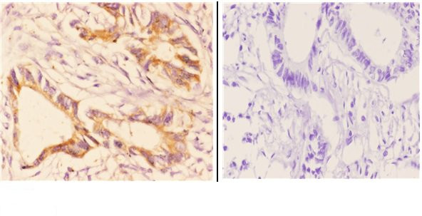 CHPF Antibody in Immunohistochemistry (Paraffin) (IHC (P))