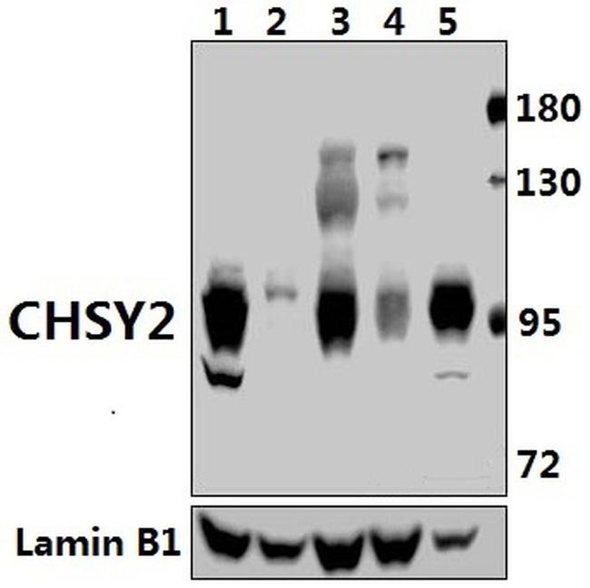 CHPF Antibody in Western Blot (WB)