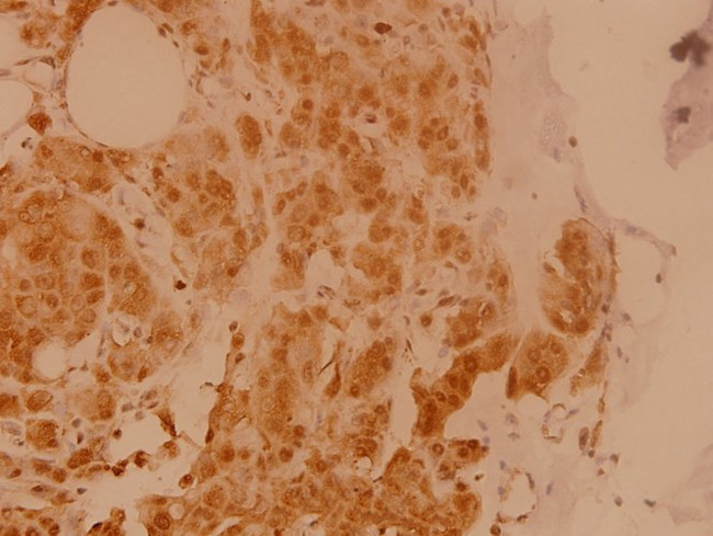 eIF5B Antibody in Immunohistochemistry (Paraffin) (IHC (P))