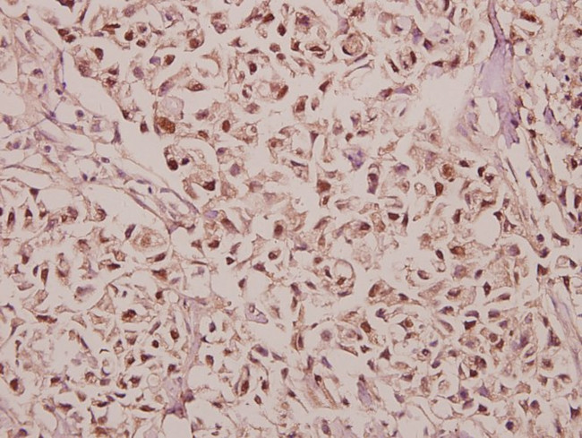 GABRG1 Antibody in Immunohistochemistry (Paraffin) (IHC (P))