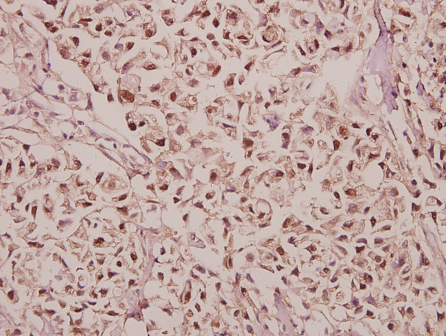 GABRG1 Antibody in Immunohistochemistry (Paraffin) (IHC (P))