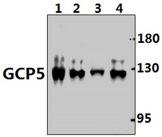 GCP5 Antibody in Western Blot (WB)