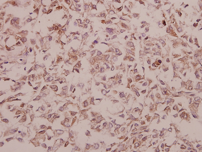 NSG1 Antibody in Immunohistochemistry (Paraffin) (IHC (P))