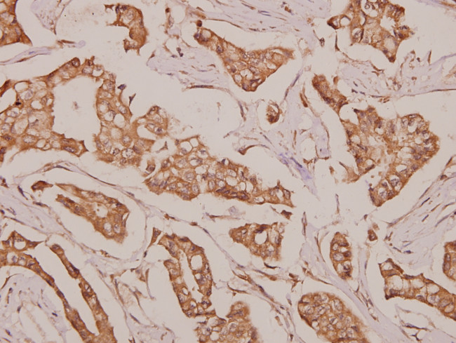 DDX52 Antibody in Immunohistochemistry (Paraffin) (IHC (P))