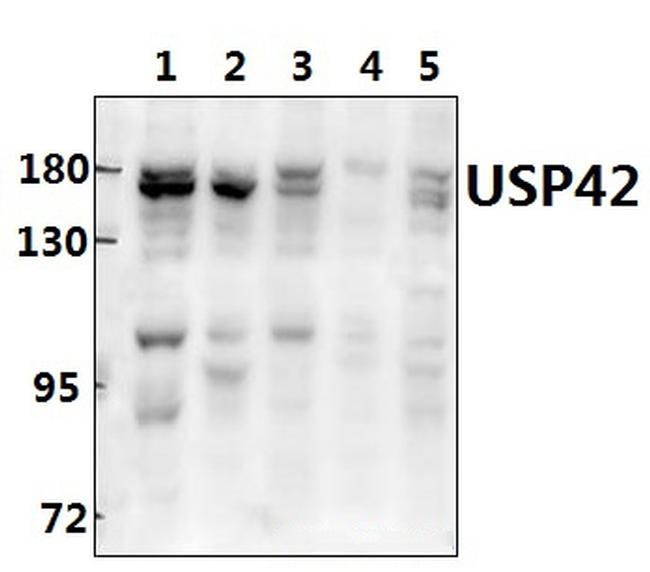 USP42 Antibody in Western Blot (WB)