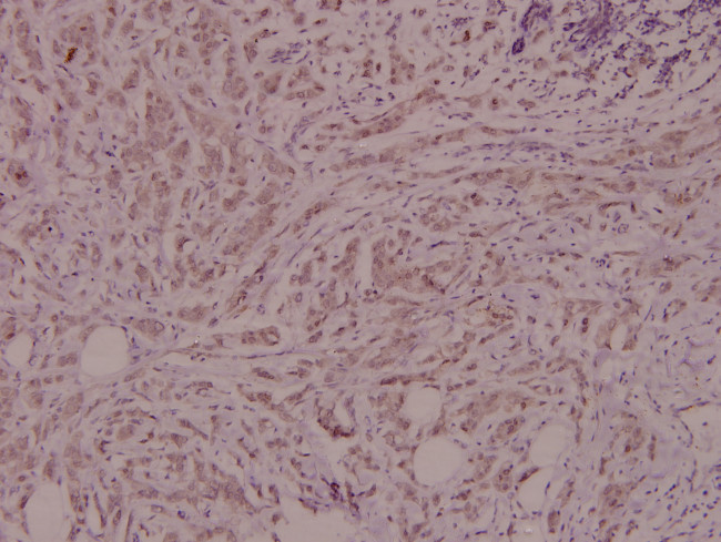 IL4R Antibody in Immunohistochemistry (Paraffin) (IHC (P))