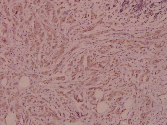 IL4R Antibody in Immunohistochemistry (Paraffin) (IHC (P))