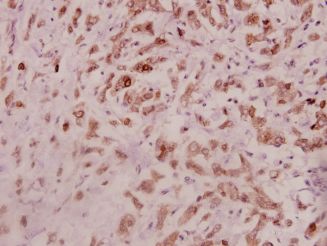 IL-11 Antibody in Immunohistochemistry (Paraffin) (IHC (P))