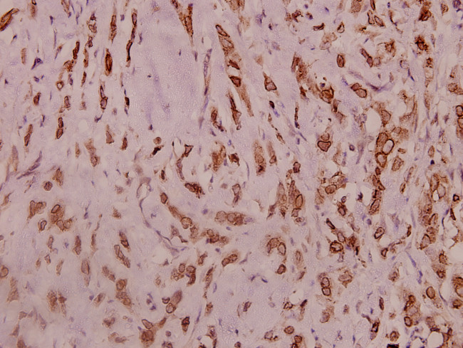 SCN2A Antibody in Immunohistochemistry (Paraffin) (IHC (P))