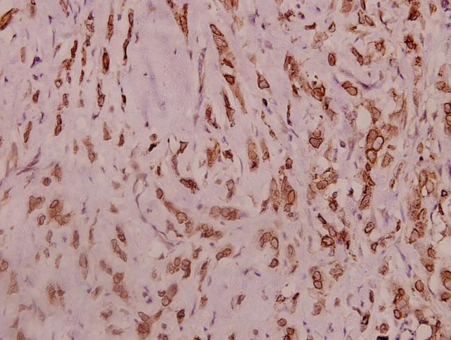 SCN2A Antibody in Immunohistochemistry (Paraffin) (IHC (P))