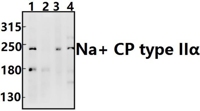 SCN2A Antibody in Western Blot (WB)