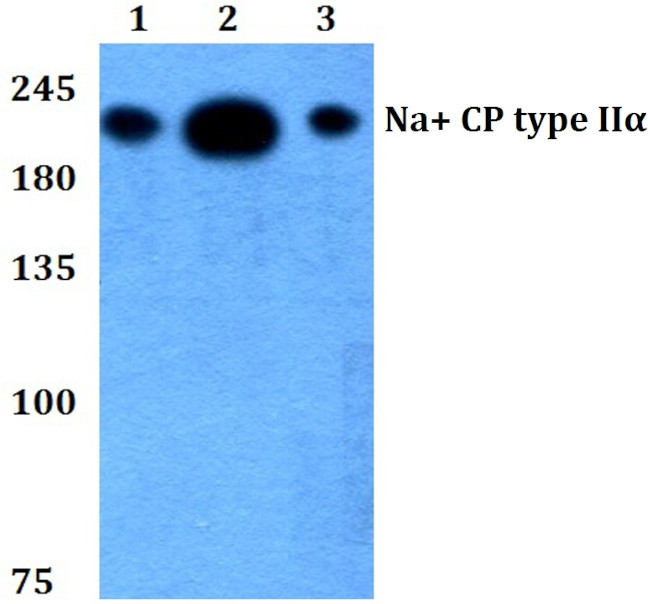 SCN2A Antibody in Western Blot (WB)