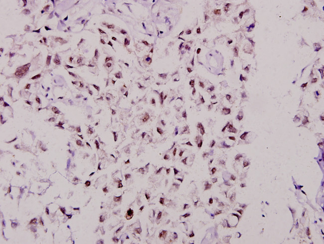 MSK1 Antibody in Immunohistochemistry (Paraffin) (IHC (P))