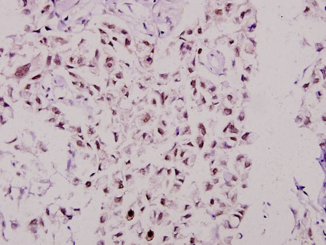 MSK1 Antibody in Immunohistochemistry (Paraffin) (IHC (P))