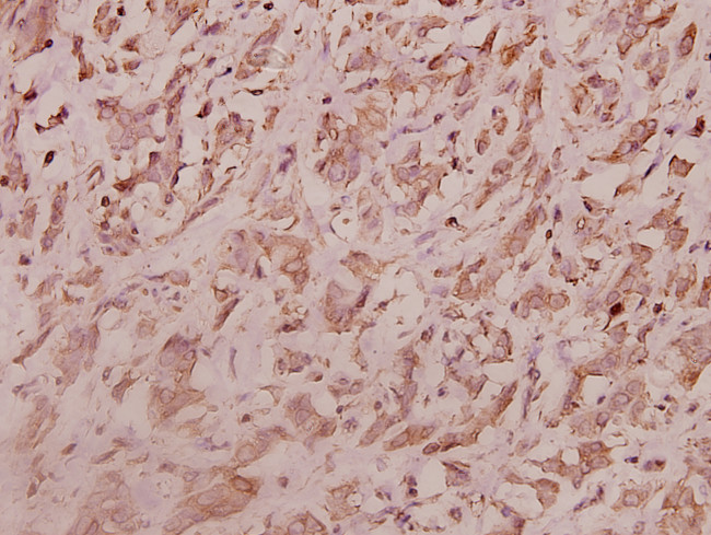 RPL7 Antibody in Immunohistochemistry (Paraffin) (IHC (P))