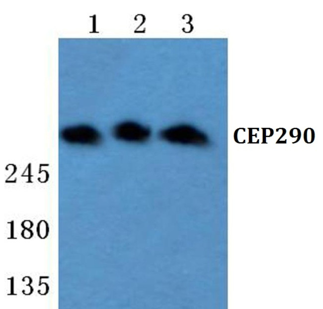 CEP290 Antibody in Western Blot (WB)