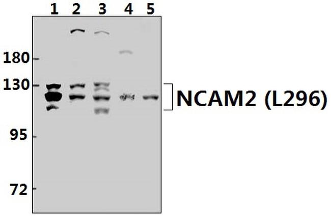 NCAM2 Antibody in Western Blot (WB)