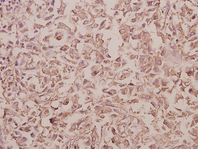 RAB5C Antibody in Immunohistochemistry (Paraffin) (IHC (P))