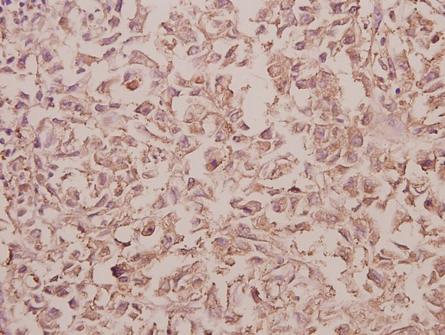 RAB5C Antibody in Immunohistochemistry (Paraffin) (IHC (P))