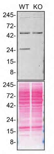 RAB5C Antibody in Western Blot (WB)