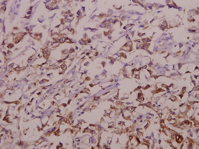 OATP1 Antibody in Immunohistochemistry (Paraffin) (IHC (P))