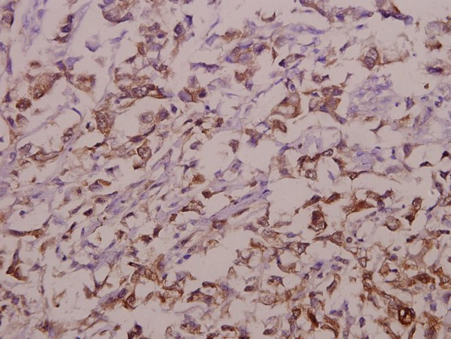 OATP1 Antibody in Immunohistochemistry (Paraffin) (IHC (P))