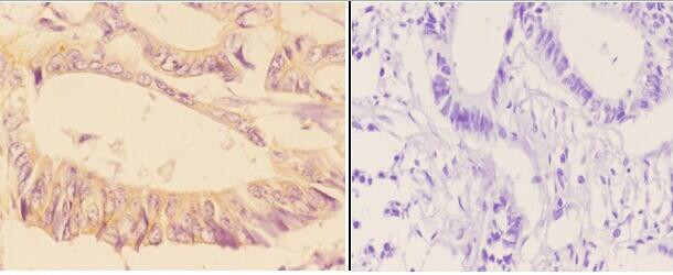 Phospho-ADD1/ADD2 (Ser726, Ser713) Antibody in Immunohistochemistry (Paraffin) (IHC (P))