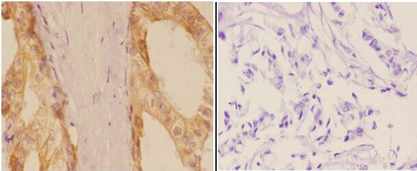 Phospho-ADD1/ADD2 (Ser726, Ser713) Antibody in Immunohistochemistry (Paraffin) (IHC (P))