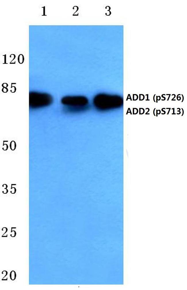 Phospho-ADD1/ADD2 (Ser726, Ser713) Antibody in Western Blot (WB)