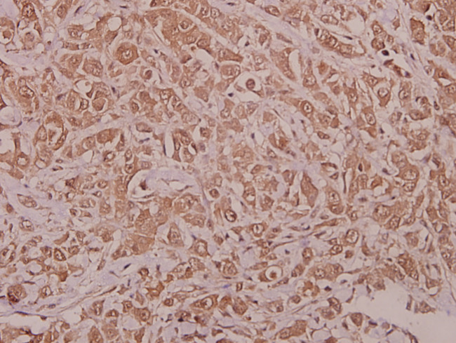 Phospho-AMPK alpha-1 (Ser486) Antibody in Immunohistochemistry (Paraffin) (IHC (P))