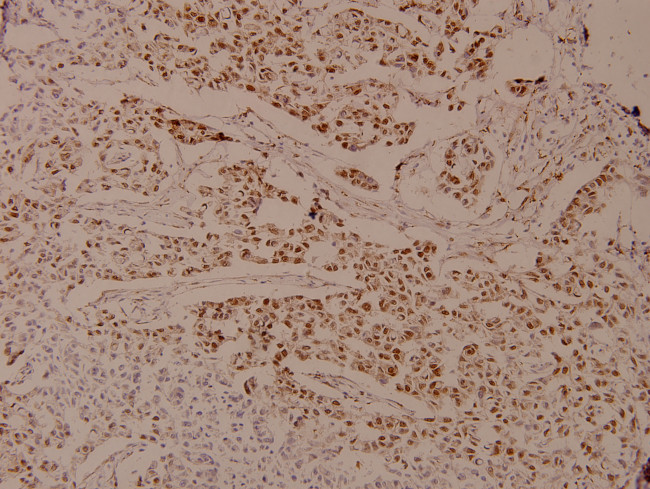 Phospho-Androgen Receptor (Ser650) Antibody in Immunohistochemistry (Paraffin) (IHC (P))