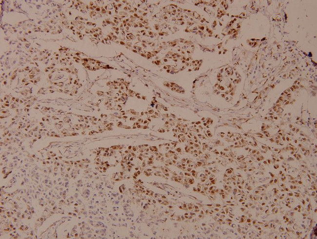 Phospho-Androgen Receptor (Ser650) Antibody in Immunohistochemistry (Paraffin) (IHC (P))