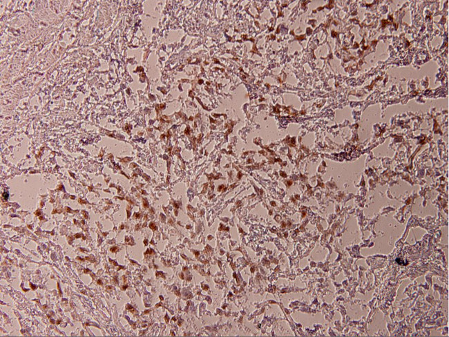 Phospho-ATF2 (Thr69) Antibody in Immunohistochemistry (Paraffin) (IHC (P))