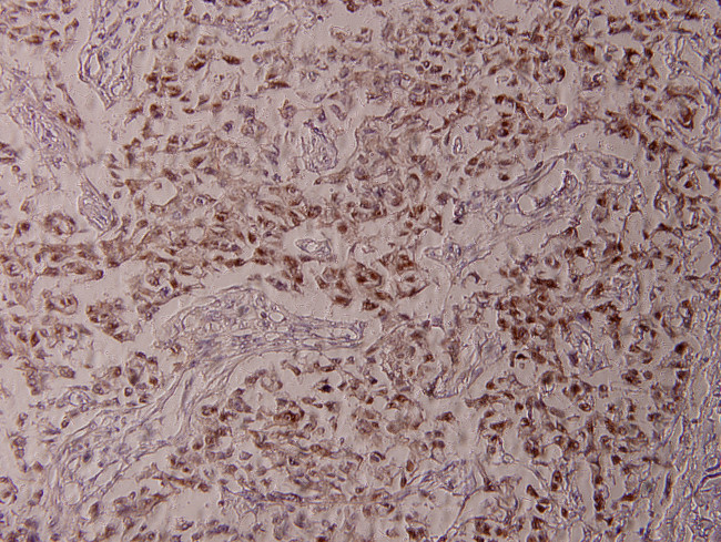 Phospho-ATF2 (Thr73) Antibody in Immunohistochemistry (Paraffin) (IHC (P))