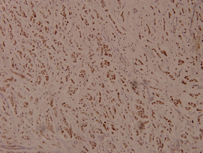 Phospho-ATF4 (Ser245) Antibody in Immunohistochemistry (Paraffin) (IHC (P))