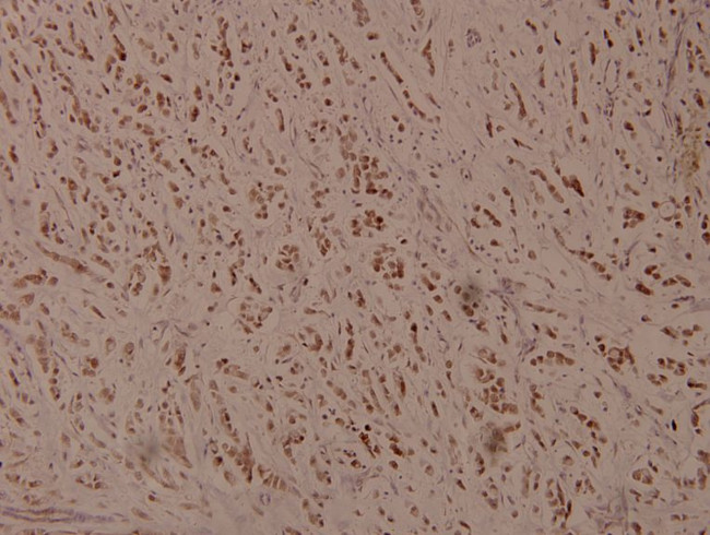 Phospho-ATF4 (Ser245) Antibody in Immunohistochemistry (Paraffin) (IHC (P))