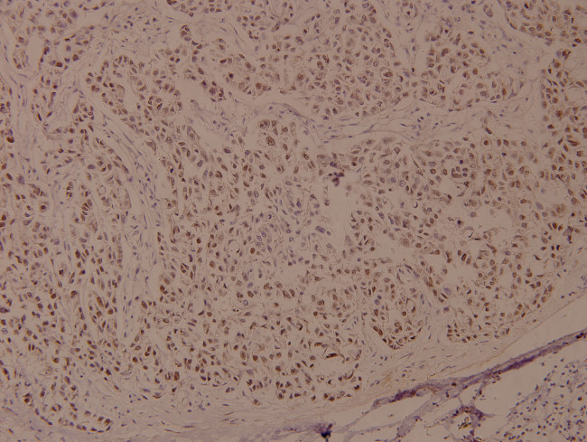 Phospho-BRCA1 (Ser1524) Antibody in Immunohistochemistry (Paraffin) (IHC (P))